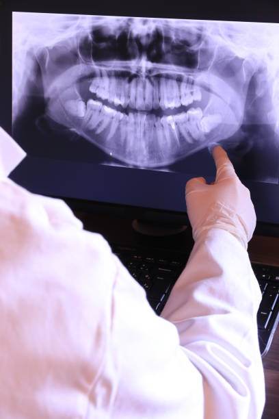 Best Emergency Treatment for Oral Infections in Herrin, IL