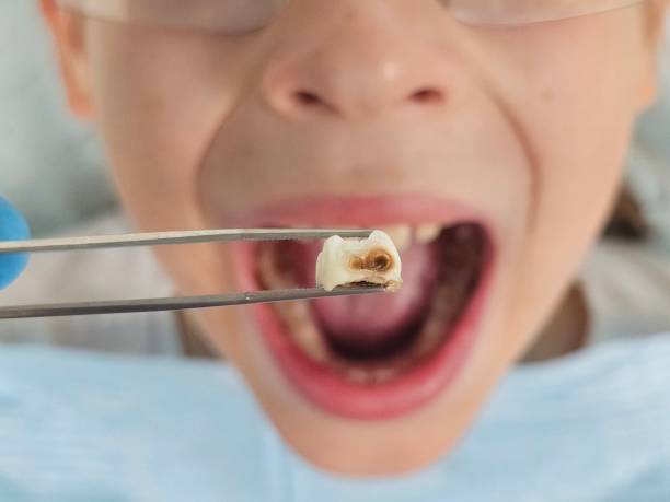 Best Emergency Pediatric Dental Care in Herrin, IL