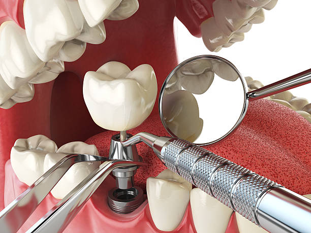 Best Emergency Care for Gum Disease in Herrin, IL